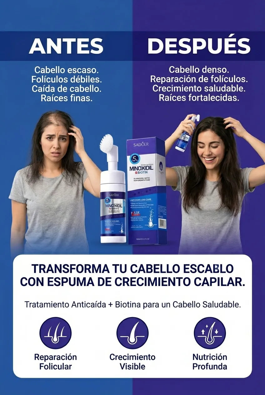 SADOER Minoxidil 5% y Biotina Espuma. Crecimiento Capilar, Densidad y Nutrición Profunda.