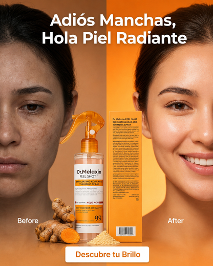 Peel Shot Kojic Acid Turmeric Serum – Sérum Exfoliante Iluminador con Ácido Kójico, Cúrcuma y AHA+BHA (80 ml)