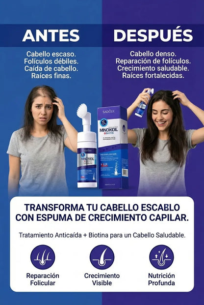 SADOER Minoxidil 5% y Biotina Espuma. Crecimiento Capilar, Densidad y Nutrición Profunda.