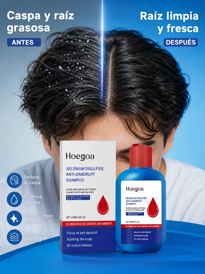 SELENIUM DISULFIDE ANTI-DANDRUFF SHAMPOO – Champú Anticaspa con Disulfuro de Selenio para Control de Caspa, Grasa y Cuidado del Cuero Cabelludo (120 ml)
